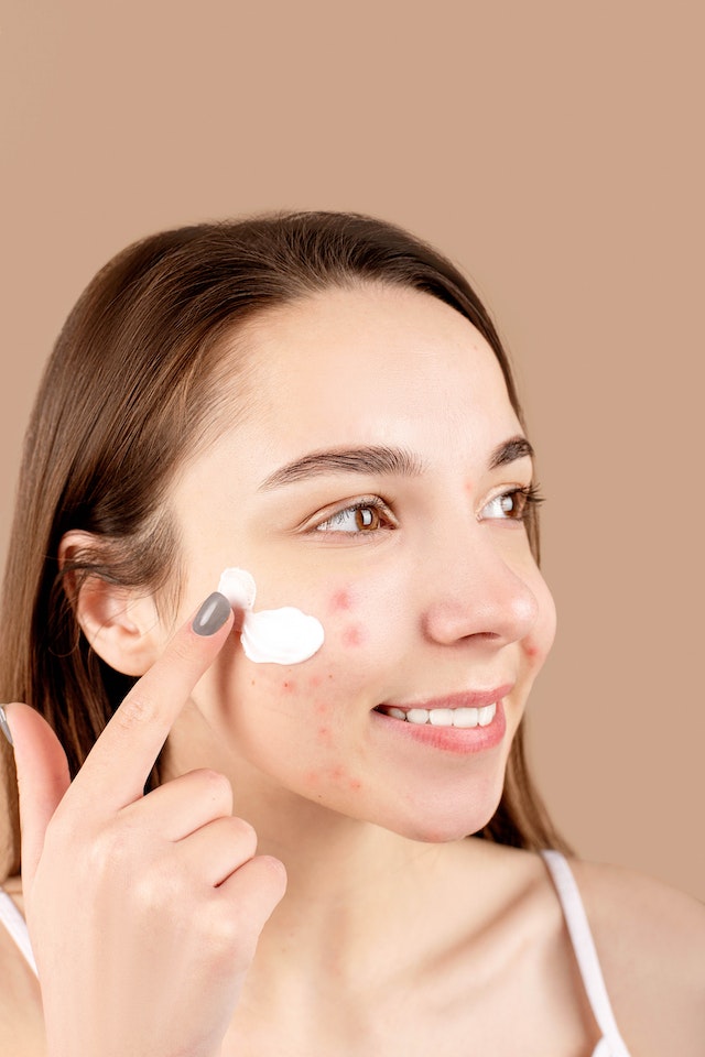 Quick and Effective Natural Methods to Get Rid of Pimples